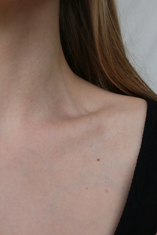 close up of a neck with small circles on the neck