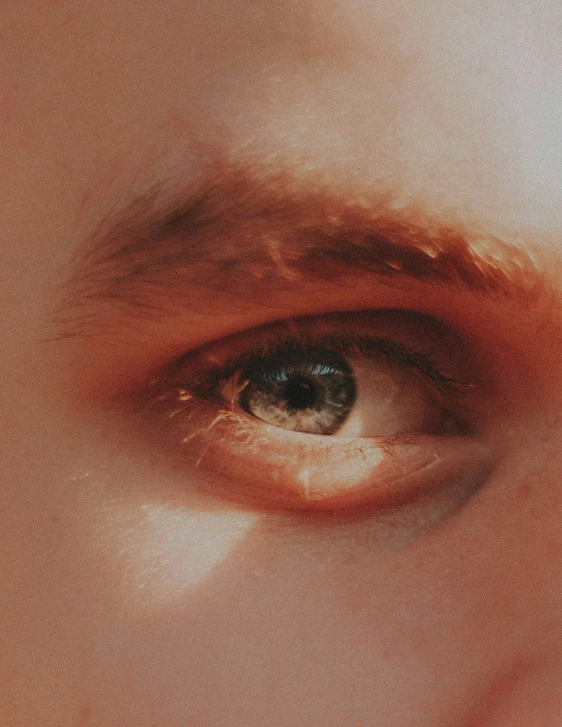 an image of a womans eye showing the red substance on her eye