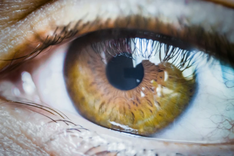 an extreme close up image of a persons eye with wrinkles on the iris and area of the lower lid