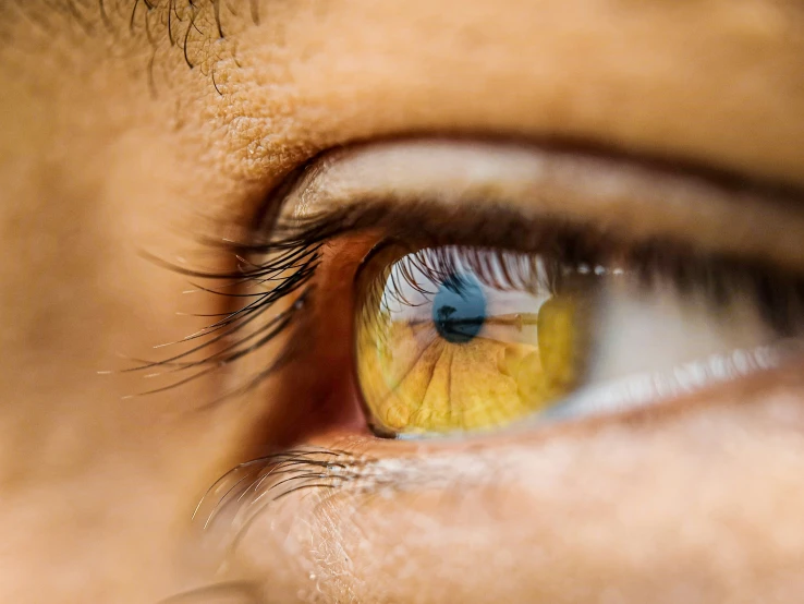 a womans eye with yellow iris closeup