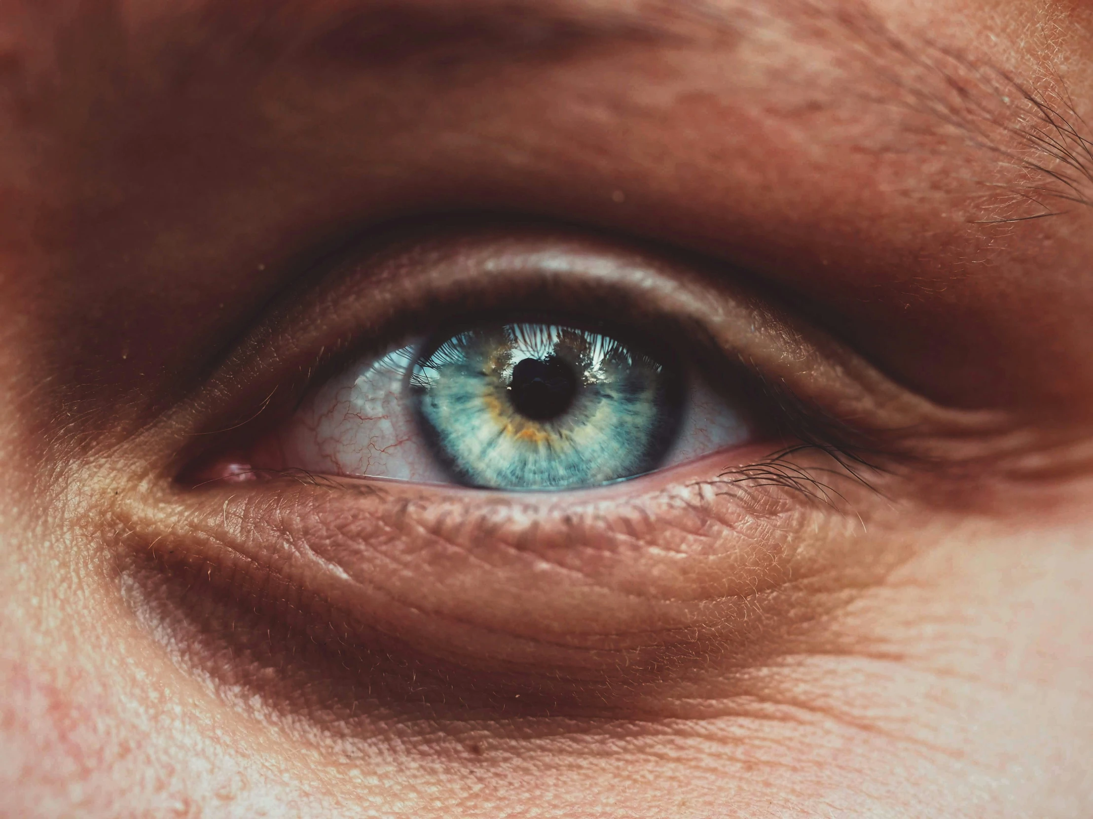 a close up of an eye with a brown ring around it