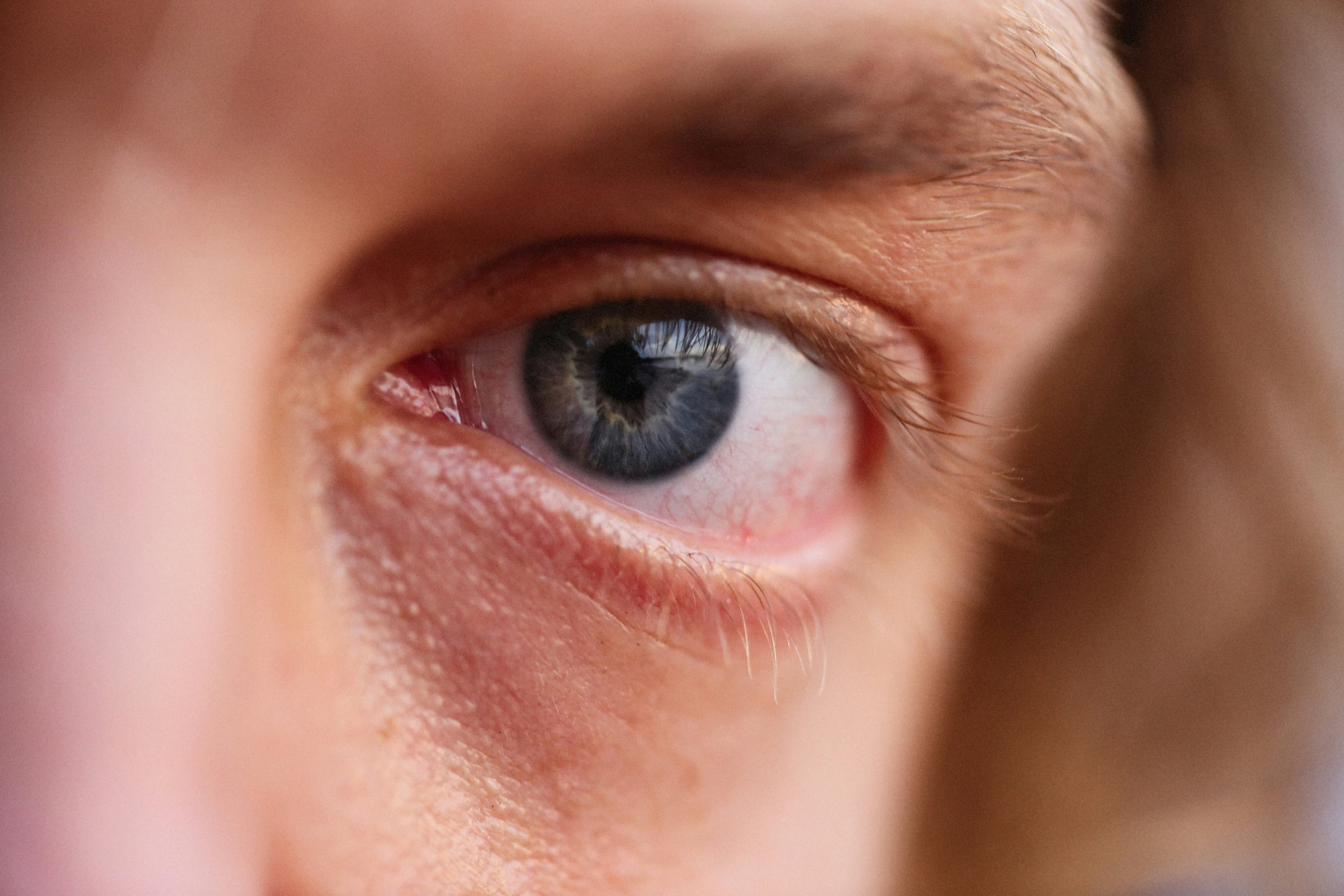 the blue eye is in the upper portion of the person's left eye