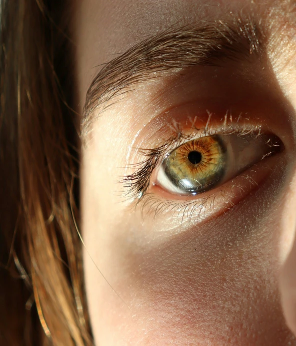 there is a closeup view of an eye with yellow iris