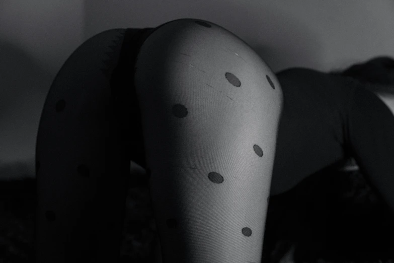 a woman has a large amount of black dots on her arm