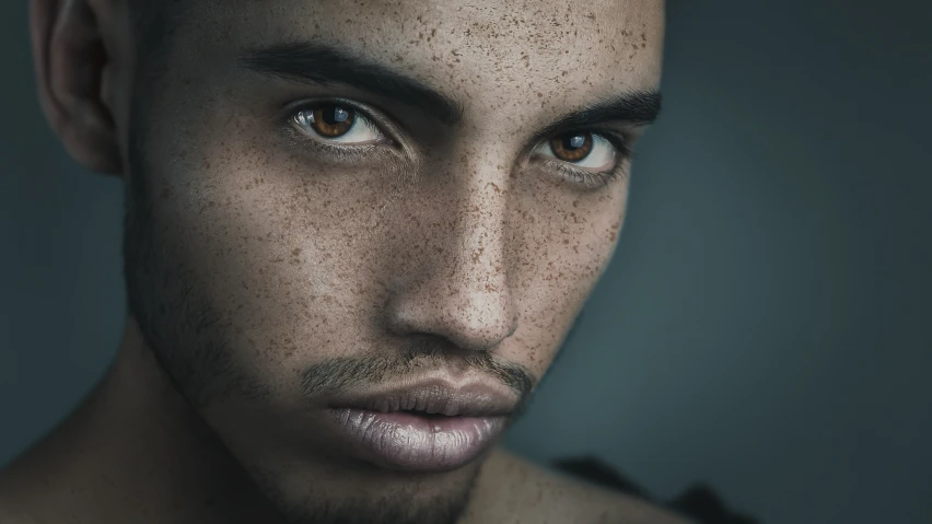 a man with freckles looking at the camera