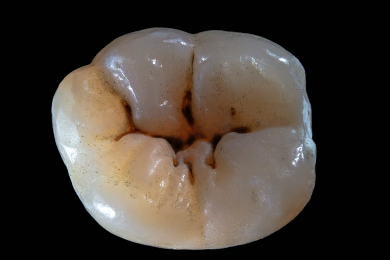 a tooth that is white with a lot of gum on it
