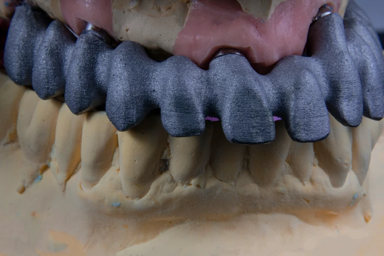 a tooth that is partially missing a front tooth