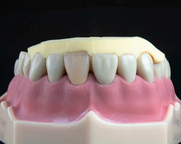 a model of teeth that looks like it has been placed on top of the model