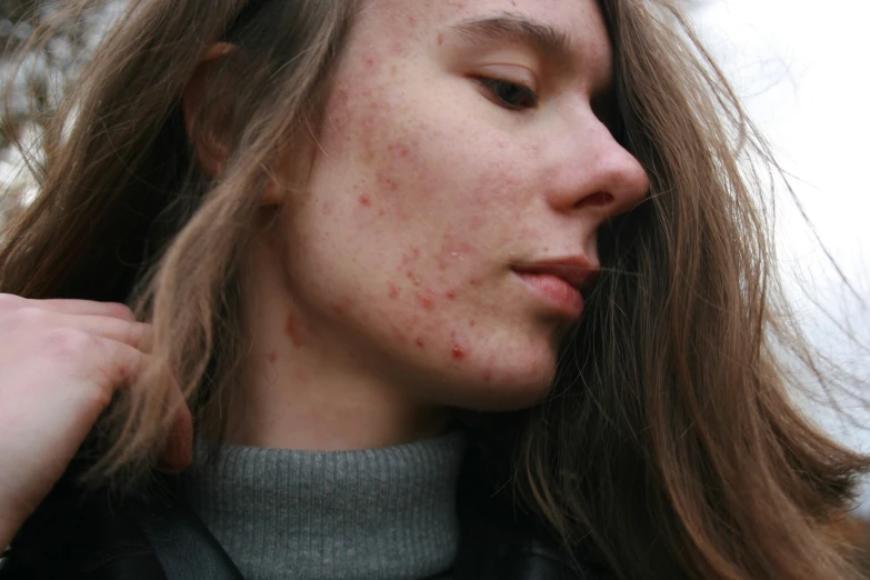 a woman with freckles is shown from the back,