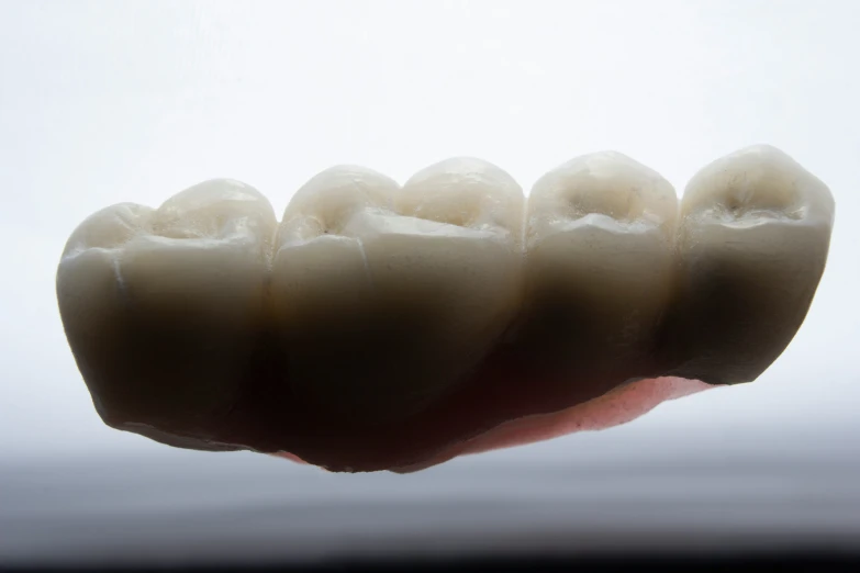 tooth decay shows in the white - coated forefinger