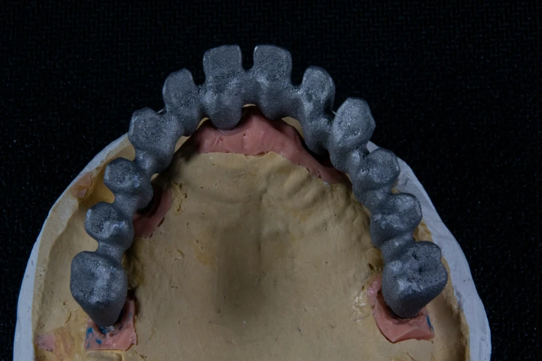 the human teeth are showing how important dental care is