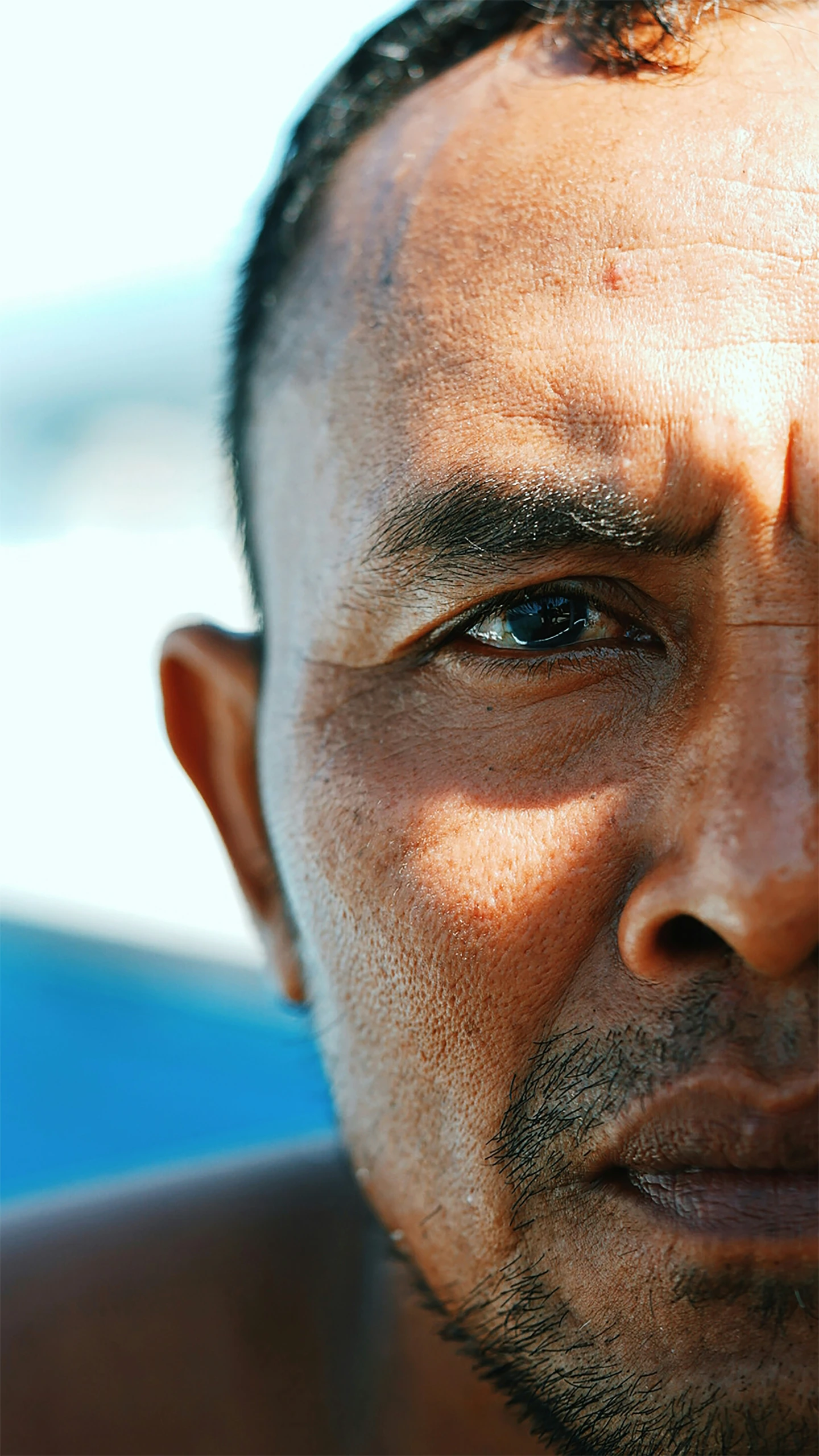 a man with  is looking straight ahead