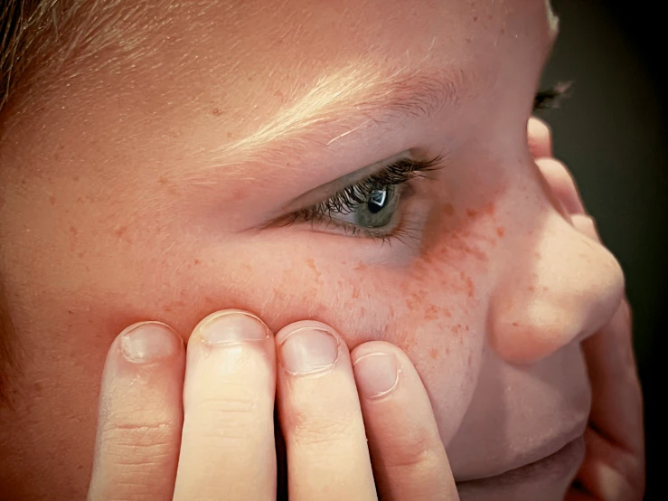 a child has freckles on their eyes and nose