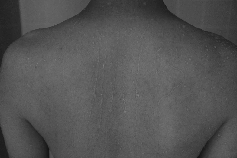 black and white pograph of the back of a person's head