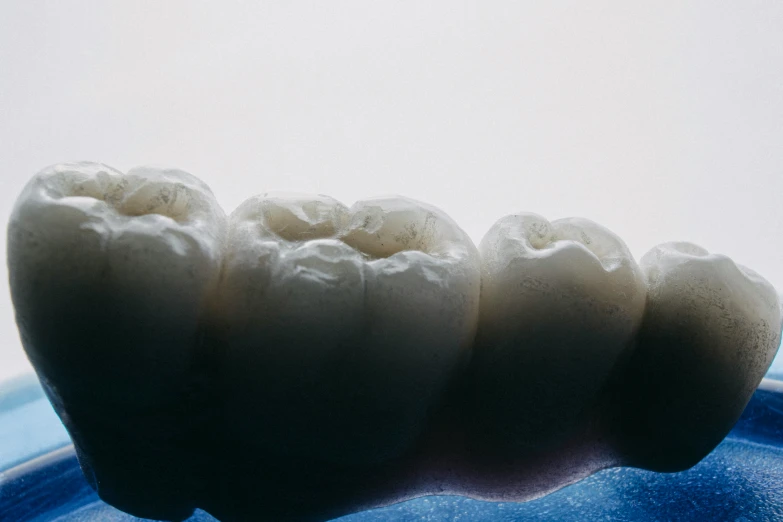 a three tooth dental model against a white background