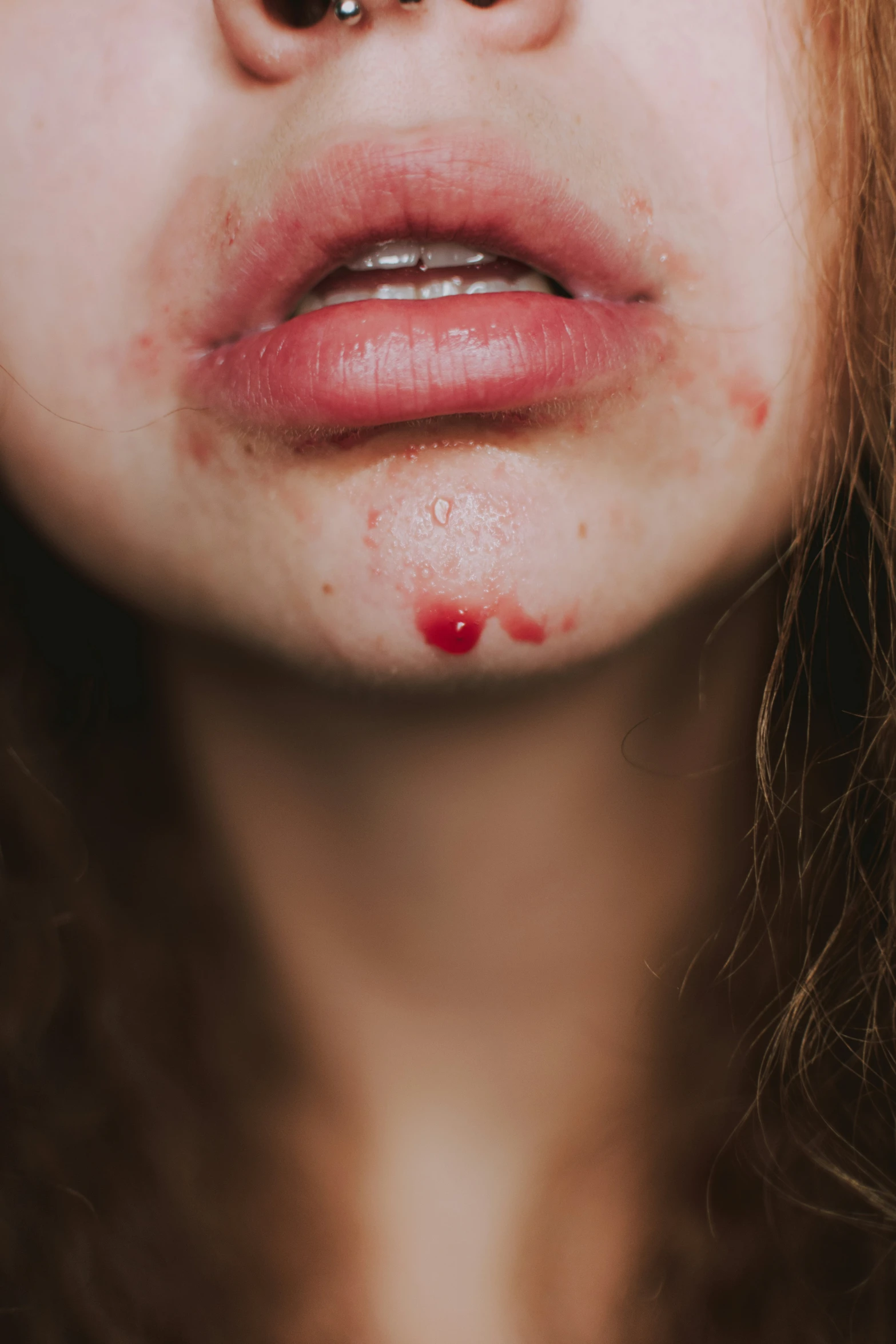 a woman's bruised lip and nose with an orange spot