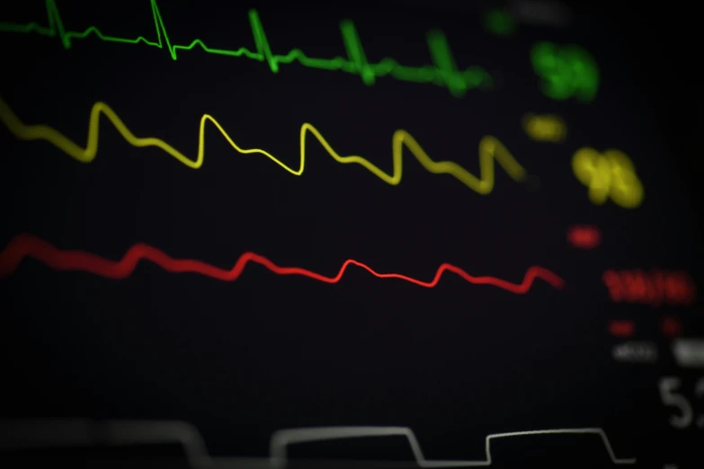 a monitor with various colored ecg lines