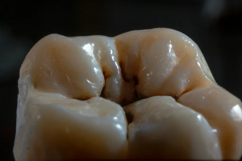 the top part of a tooth with a bite taken out