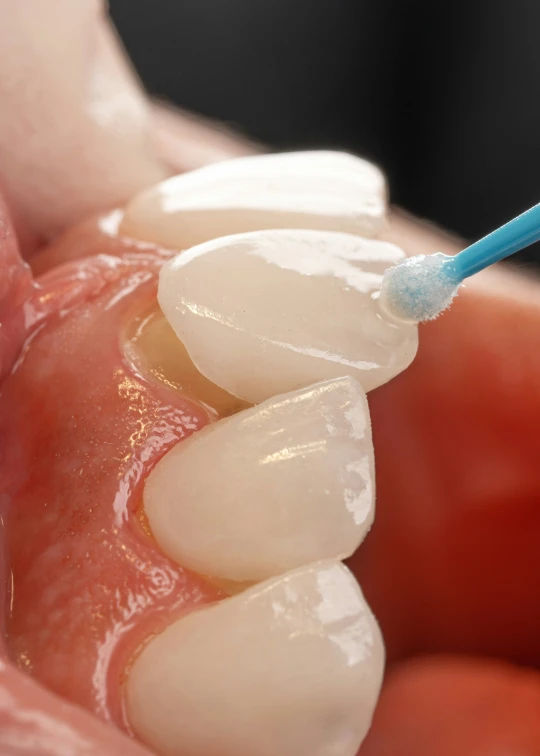 a person with blue and white toothbrush brushing their teeth