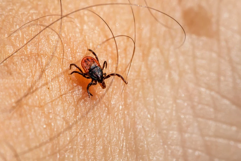 a close up of a bug on a human body