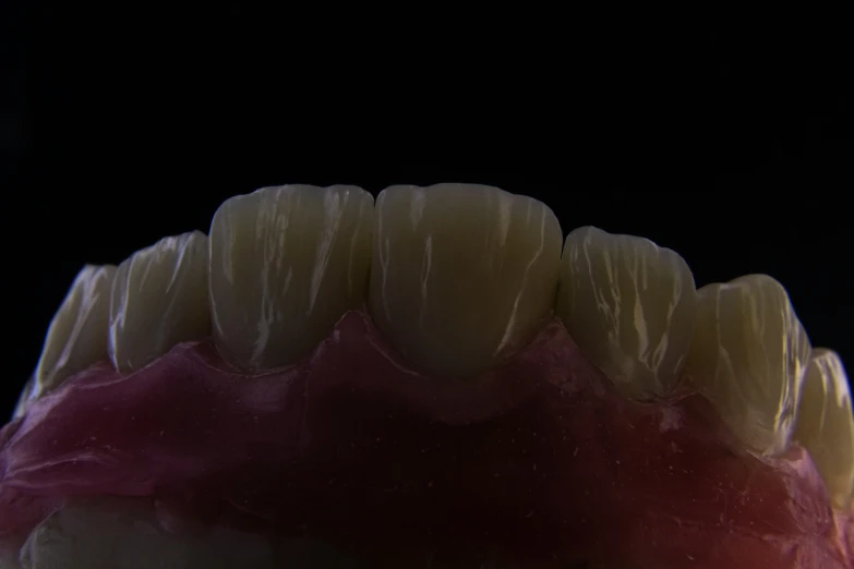 a partial view of an unhealthy looking human tooth
