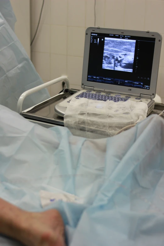 an injured person lying in a hospital bed and with soing on top of his laptop