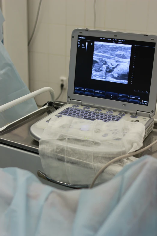 an open laptop computer sitting on top of a table