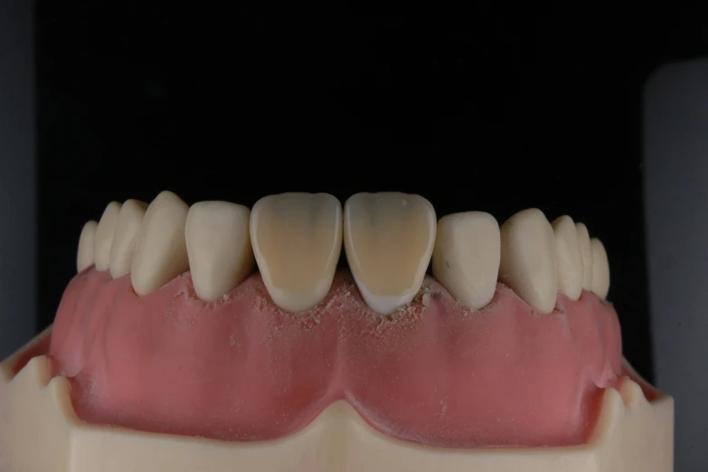 an old model human smile has teeth missing