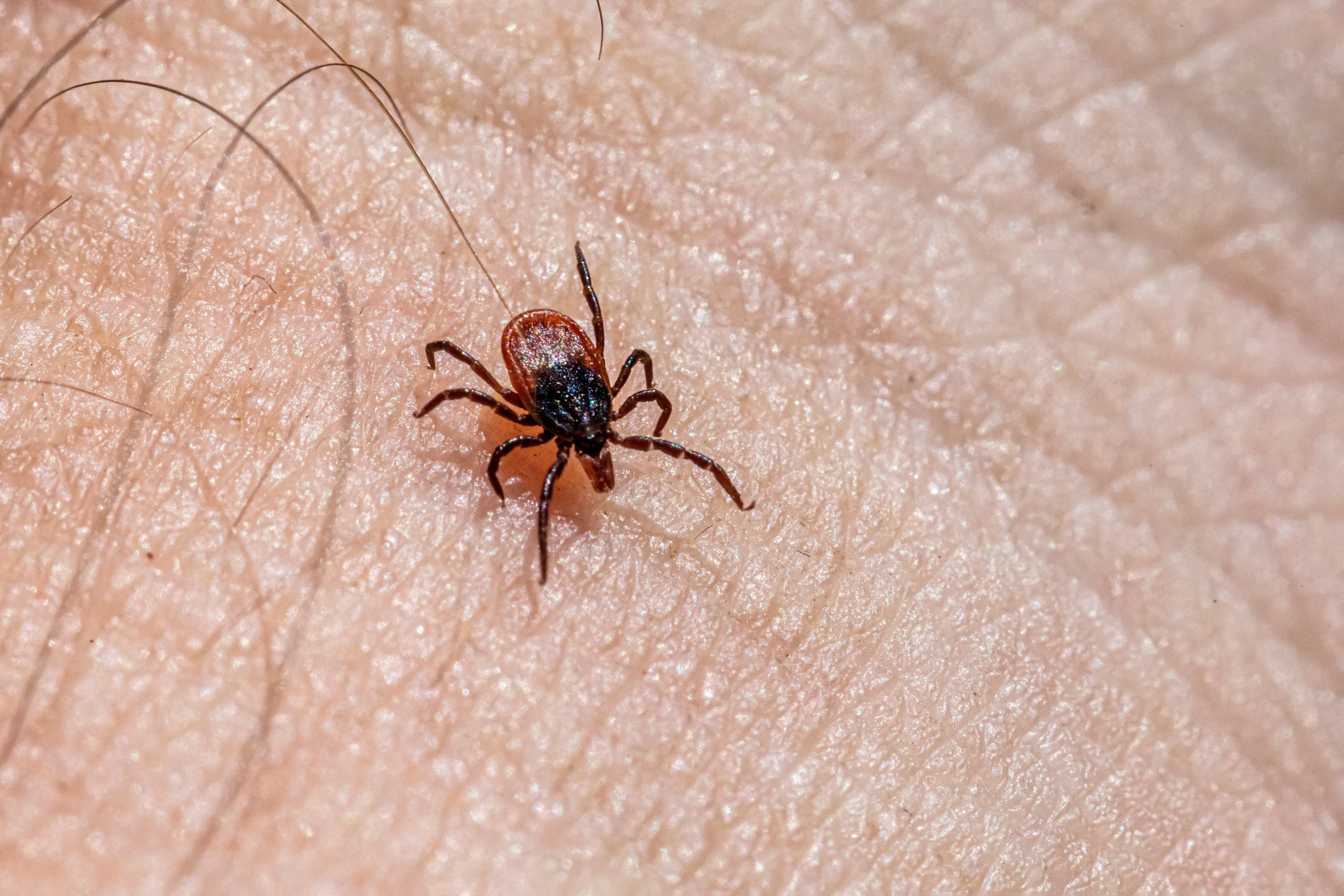 a small brown spider on the side of a persons stomach