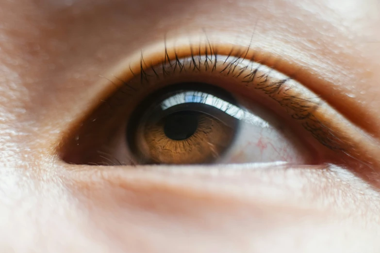 a person's eyes with brown and yellow colored eyes