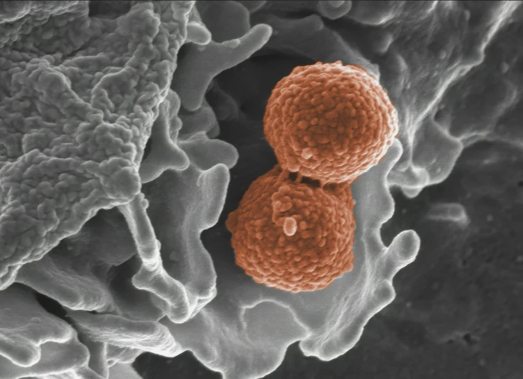 a closeup of an adult cell with the cellphone attached to it