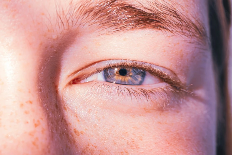 the blue eyes have brown spots on their forehead